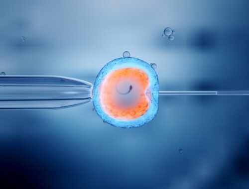 Fécondation in vitro (FIV)