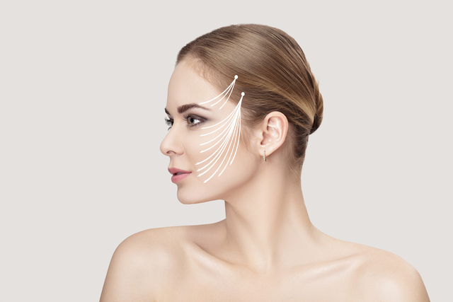 Fils tenseurs visage durée