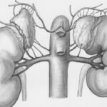 Insuffisance rénale